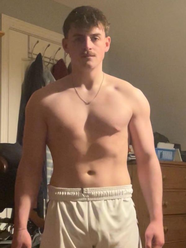 Matt before
